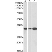 abx431003 (0.1 µg/ml) staining of Human (A), Mouse (B) and Rat (C) Brain lysate (35 µg protein in RIPA buffer). Primary incubation was 1 hour. Detected by chemiluminescence.