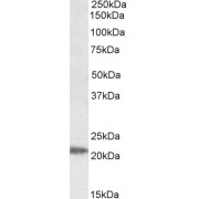 abx431005 (0.05 µg/ml) staining of Human Liver lysate (35 µg protein in RIPA buffer). Primary incubation was 1 hour. Detected by chemiluminescence.