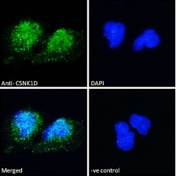 Casein Kinase 1, Delta (CSNK1D) Antibody