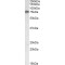 Arginine--tRNA Ligase, Cytoplasmic (RARS1) Antibody