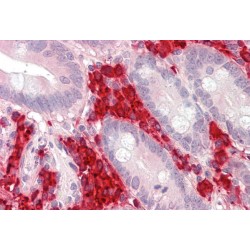 Thioredoxin Domain-Containing Protein 5 (TXNDC5) Antibody