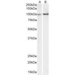 Alpha Actinin 1 (ACTN1) Antibody