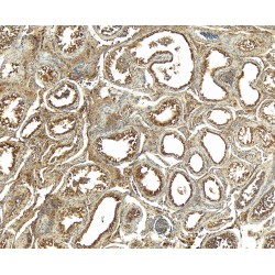 Monoamine Oxidase B (MAOB) Antibody