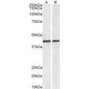 Biotinylated abx431048 (0.1 µg/ml) staining of Mouse (A) and Rat (B) Liver lysates (35 µg protein in RIPA buffer), exactly mirroring its parental non-biotinylated product. Primary incubation was 1 hour. Detected by chemiluminescence, using streptavidin-HRP and using NAP blocker as a substitute for skimmed milk.