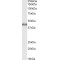 Acetyl Coenzyme A Acetyltransferase 1 (ACAT1) Antibody