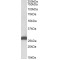 Electron Transfer Flavoprotein Beta Polypeptide (ETFB) Antibody