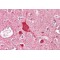 ATP Binding Cassette Transporter A2 (ABCA2) Antibody