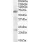 Neuronal Acetylcholine Receptor Subunit Alpha-4 (CHRNA4) Antibody