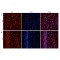 Neuronal Acetylcholine Receptor Subunit Alpha 7 (CHRNA7) Antibody