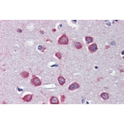 Neuronal Acetylcholine Receptor Subunit Alpha 7 (CHRNA7) Antibody