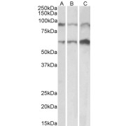 abx431074 (0.1 µg/ml) staining of Mouse (A), Rat (B) and Pig (C) Heart lysate (35 µg protein in RIPA buffer). Primary incubation was 1 hour. Detected by chemiluminescence.