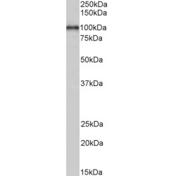 ADAM Metallopeptidase Domain 12 (ADAM12) Antibody