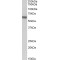 Alpha 1B Adrenergic Receptor (ADRA1B) Antibody