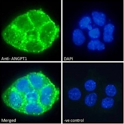 Angiopoietin-1 (ANGPT1) Antibody