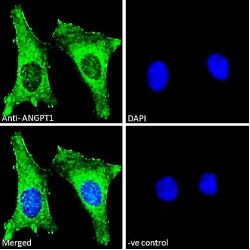 Angiopoietin-1 (ANGPT1) Antibody