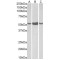 Retinal Dehydrogenase 1 (ALDH1A1) Antibody