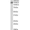 ALK Tyrosine Kinase Receptor (ALK) Antibody