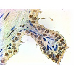 Androgen Receptor (AR) Antibody