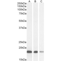 ARF1, 2, 3, 4 Antibody