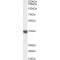 Cyclic AMP-Dependent Transcription Factor ATF-4 (ATF4) Antibody