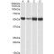 ATP Synthase Subunit Alpha, Mitochondrial (ATP5F1A) Antibody