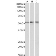 abx431117 (0.3 µg/ml) staining of Human (A), Mouse (B) and Rat (C) Heart lysates (35 µg protein in RIPA buffer). Primary incubation was 1 hour. Detected by chemiluminescence.