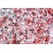 Axis Inhibition Protein 1 (AXIN1) Antibody