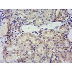 PBR Antibody