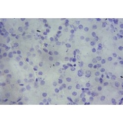 PBR Antibody