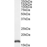 abx431129 (0.01 µg/ml) staining of Mouse Kidney lysate (35 µg protein in RIPA buffer). Detected by chemiluminescence.