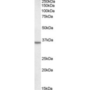 abx431134 staining (0.5 µg/ml) of A431 lysate (RIPA buffer, 35 µg total protein per lane). Primary incubated for 1 hour. Detected by western blot using chemiluminescence.