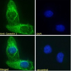 Caveolin 1 (CAV1) Antibody