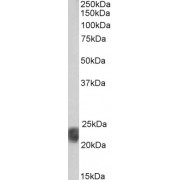 Biotinylated abx431142 (1 µg/ml) staining of Human Spleen lysate (35 µg protein in RIPA buffer), exactly mirroring its parental non-biotinylated product. Primary incubation was 1 hour. Detected by chemiluminescence, using streptavidin-HRP and using NAP blocker as a substitute for skimmed milk.