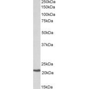 abx431145 (0.3 µg/ml) staining of Daudi lysate (35 µg protein in RIPA buffer). Primary incubation was 1 hour. Detected by chemiluminescence.