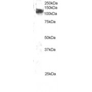 abx431146 staining (2 µg/ml) of 3T3 lysate (RIPA buffer, 35 µg total protein per lane). Primary incubated for 1 hour. Detected by western blot using chemiluminescence.