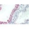 Gastrin/Cholecystokinin Type B Receptor (CCKBR) Antibody