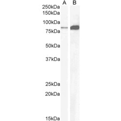 Gastrin/Cholecystokinin Type B Receptor (CCKBR) Antibody