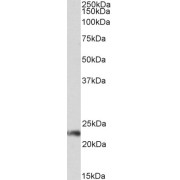 abx431152 (0.3 µg/ml) staining of Jurkat lysate (35 µg protein in RIPA buffer). Primary incubation was 1 hour. Detected by chemiluminescence.