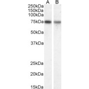 abx431159 (1 µg/ml) staining of Mouse (A) and Rat (B) Brain lysate (35 µg protein in RIPA buffer). Detected by chemiluminescence.