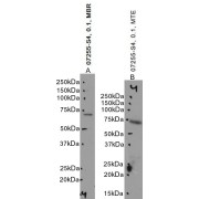 WB analysis. Images A and B: Mouse Brain and Testes lysate using Choline O-Acetyltransferase (Chat) Antibody (0.1 µg/ml).