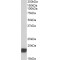 Cold-Inducible RNA-Binding Protein (CIRBP) Antibody
