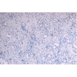 Suppressor of Cytokine Signaling 1 (SOCS1) Antibody