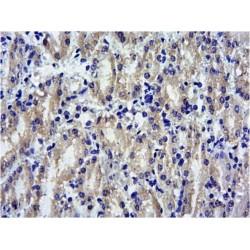 Suppressor of Cytokine Signaling 1 (SOCS1) Antibody