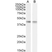 abx431167 (0.03 µg/ml) staining of Human (A) and Mouse (B) Heart lysates (35 µg protein in RIPA buffer). Detected by chemiluminescence.