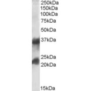 abx431170 (0.1 µg/ml) staining of Human Frontal Cortex lysate (35 µg protein in RIPA buffer). Detected by chemiluminescence.