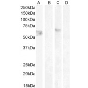 abx431171 (0.1 µg/ml) staining of HeLa lysate non-glycosylated (A) + peptide (B) and (0.5 µg/ml) HeLa lysate glycosylated (C) + peptide (D), (35 µg protein in RIPA buffer). Detected by chemiluminescence.