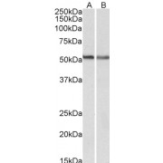 abx431173 (0.3 µg/ml) staining of A549 (A) and NIH3T3 (B) lysates (35 µg protein in RIPA buffer). Primary incubation was 1 hour. Detected by chemiluminescence.