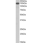 abx431177