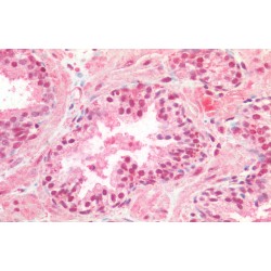 Cyclic AMP-Responsive Element-Binding Protein 1 (CREB1) Antibody