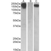 HEK293 lysate (10 µg protein in RIPA buffer) overexpressing Human CSF1R with C-terminal MYC tag probed with abx431186 (0.5 µg/ml) in Lane A and probed with anti-MYC Tag (1/1000) in lane C. Mock-transfected HEK293 probed with abx431186 (1mg/ml) in Lane B. Primary incubations were for 1 hour. Detected by chemiluminescence.